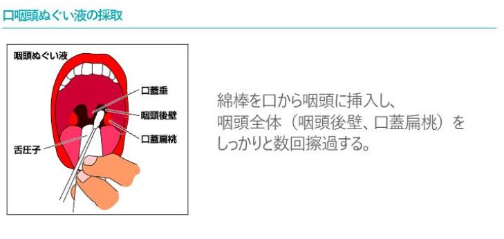 Genedia Covid29 テストキット